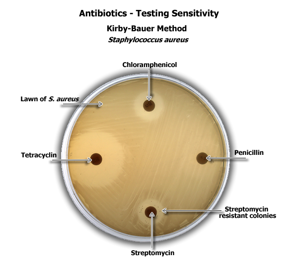 Diffusion Staphylococcus Angle Aureus Test Circle Disk PNG Image