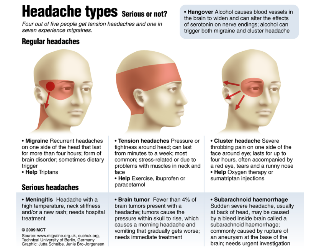 Ache Head Face Eyewear Headache Download HD PNG Transparent PNG Image