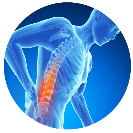 Back Pain Picture Free Photo PNG Transparent PNG Image