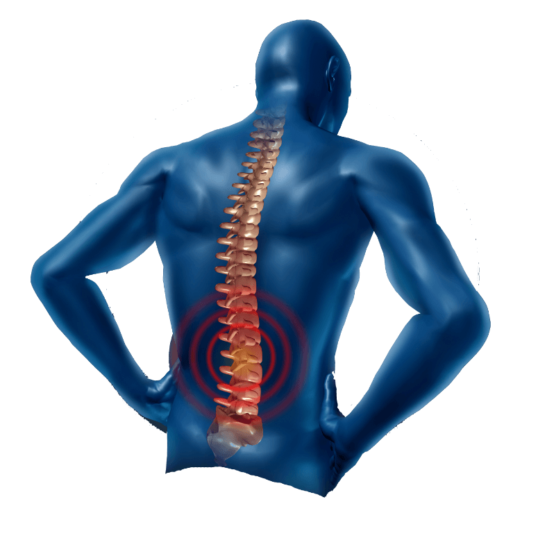 Back Pain Free Download PNG HQ Transparent PNG Image