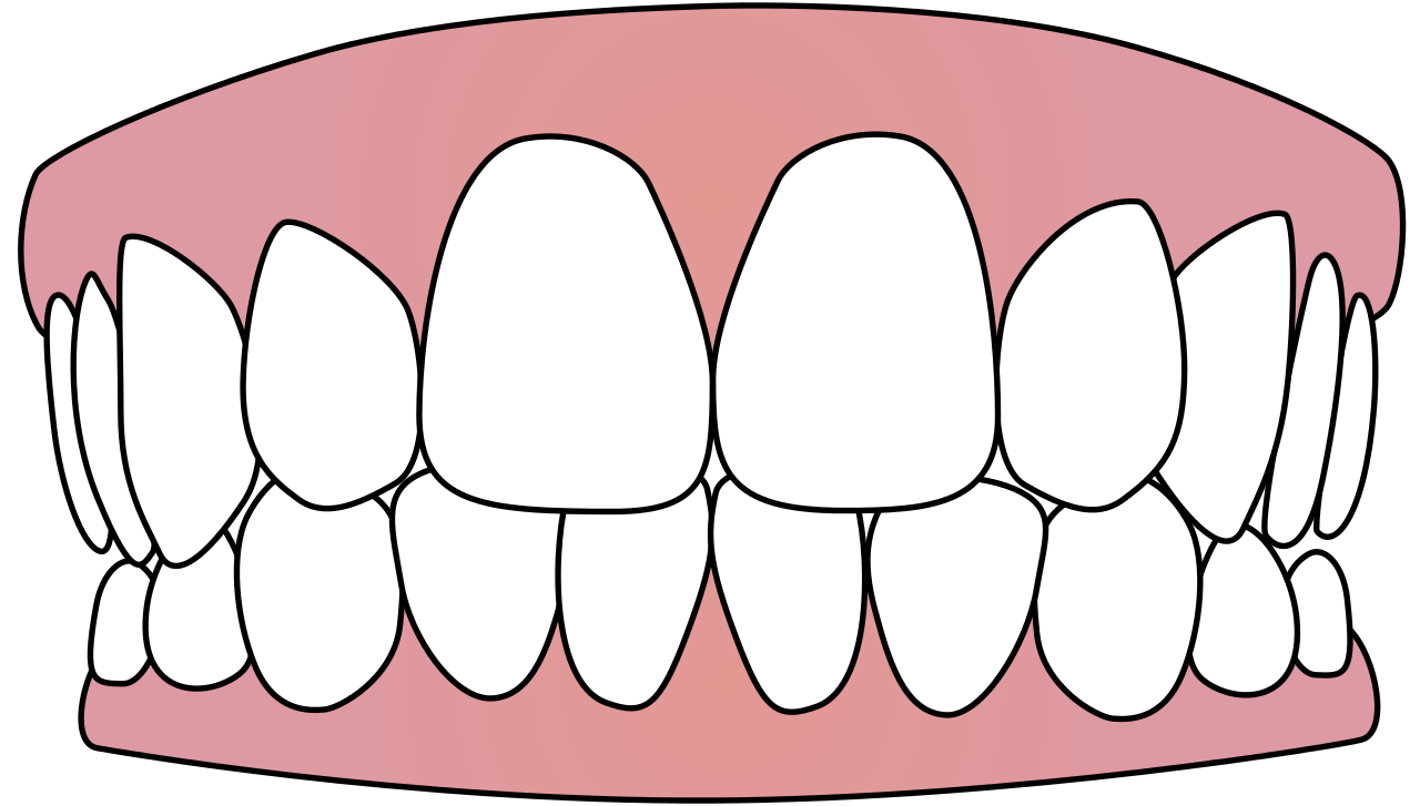 Clean Tooth Free Download PNG HD Transparent PNG Image