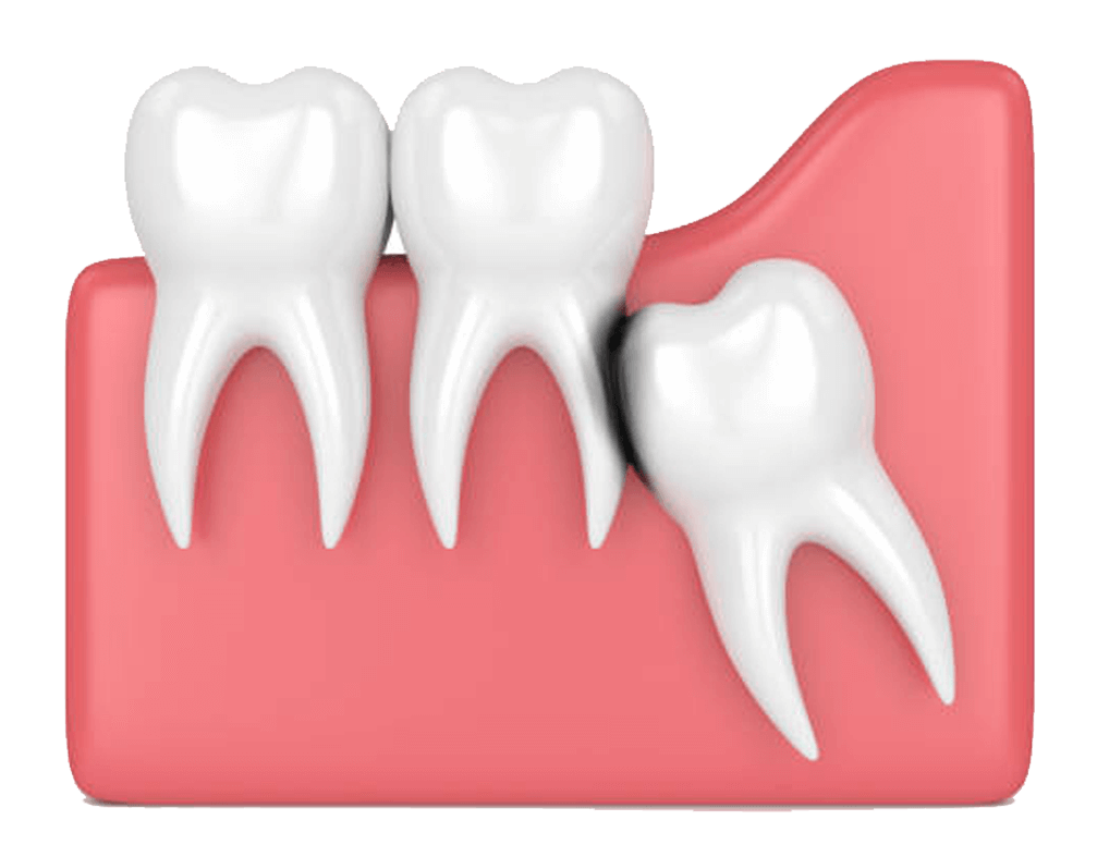 Crying Tooth Free HQ Image Transparent PNG Image