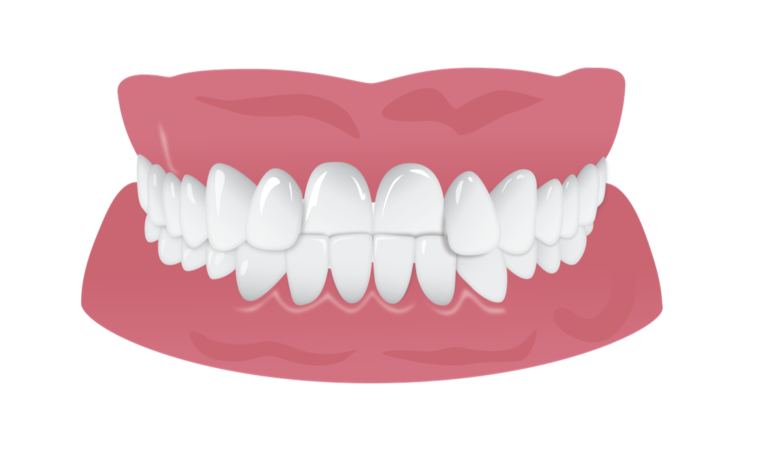 Healthy Tooth Free Transparent Image HD Transparent PNG Image