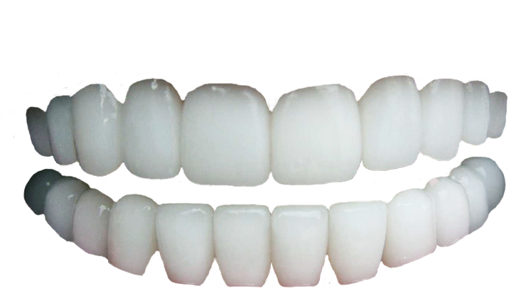 White Tooth Free Clipart HD Transparent PNG Image